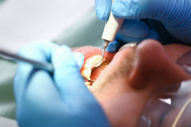 Best Emergency Dentist for Knocked-Out Tooth in Makawao, HI